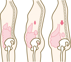 下腹ぽっこりの原因は内臓下垂 臨床歴25年の鍼灸師がズバリ答えます
